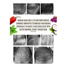 Surface Hair - Awaken Therapeutic Shampoo – Natural Ingredients for Thinning Hair and a Healthy Scalp -33.8 fl oz