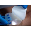 Extra Thin Hydrocolloid Sterile Wound Dressing 15cmx15cm x 5 (15x15cm)