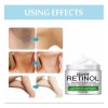 Crema Aclarante Íntima Retinol Unifica Tono Genitales Axilas