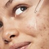 Sérum Facial Antimanchas E.L.F. Cosmetics Blemish Breakthrough