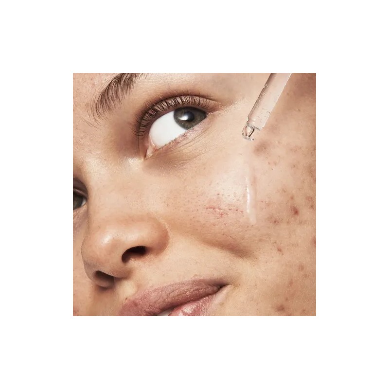 Sérum Facial Antimanchas E.L.F. Cosmetics Blemish Breakthrough