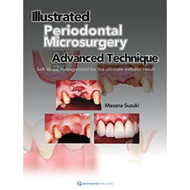Illustrated Periodontal Microsurgery: Advanced Technique Soft Tissue Management for the Ultimate Esthetic Result