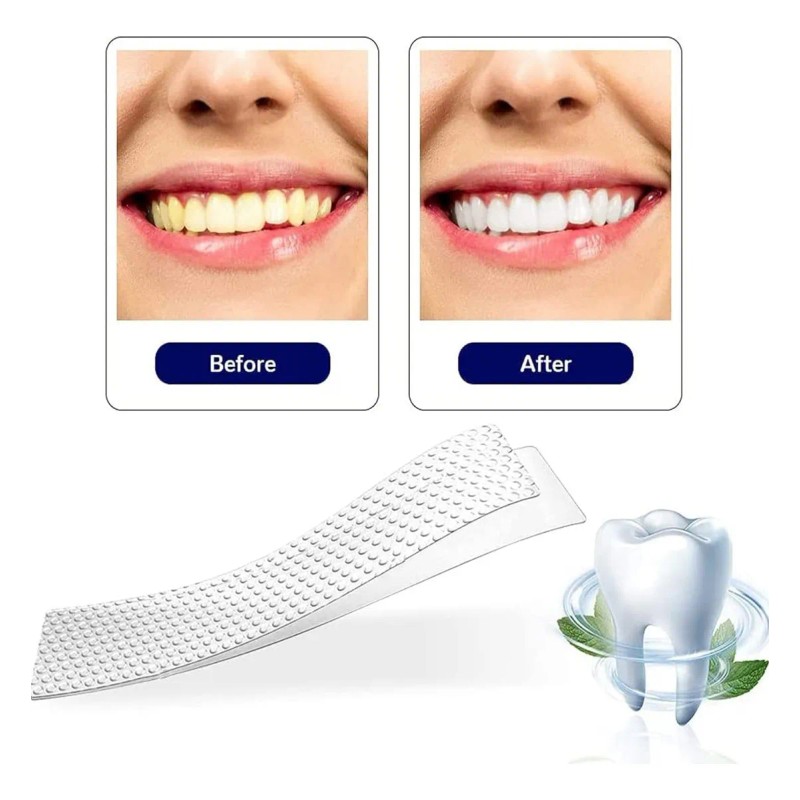 Tiras Blanqueadoras Dentales White Higiene Bucal Alien Technology