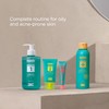 ISDIN Acniben On The Spot, Facial Pimples Corrector Drying Gel,