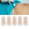 5pcs Scar Sheets Waterproof Wound Dressing Breathable Full Coverage Hygienic