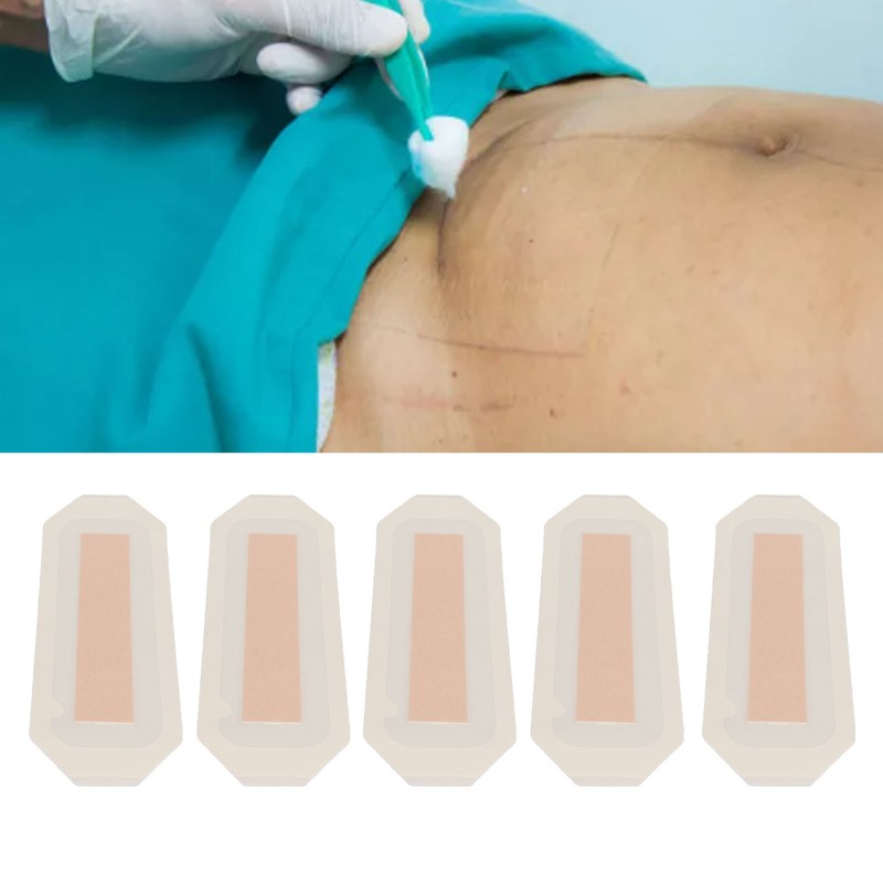 5pcs Scar Sheets Waterproof Wound Dressing Breathable Full Coverage Hygienic