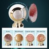 Blackhead Vacuum Suction Machine 3 Gears Magnify Pores Cleaning Electric