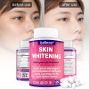 Balincer Glutathione capsules--main - 120CapsulesX2