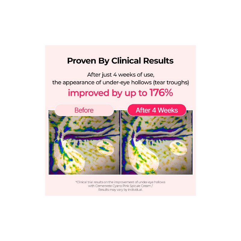 Dr.Melaxin [Dr.Melaxin]Cemenrete Cyano Pink Spicule Cream 50ml