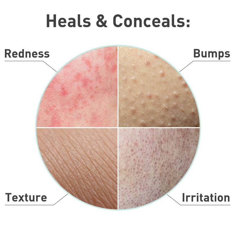 Procure Rosacare Sheet Face Mask - 5 Pack