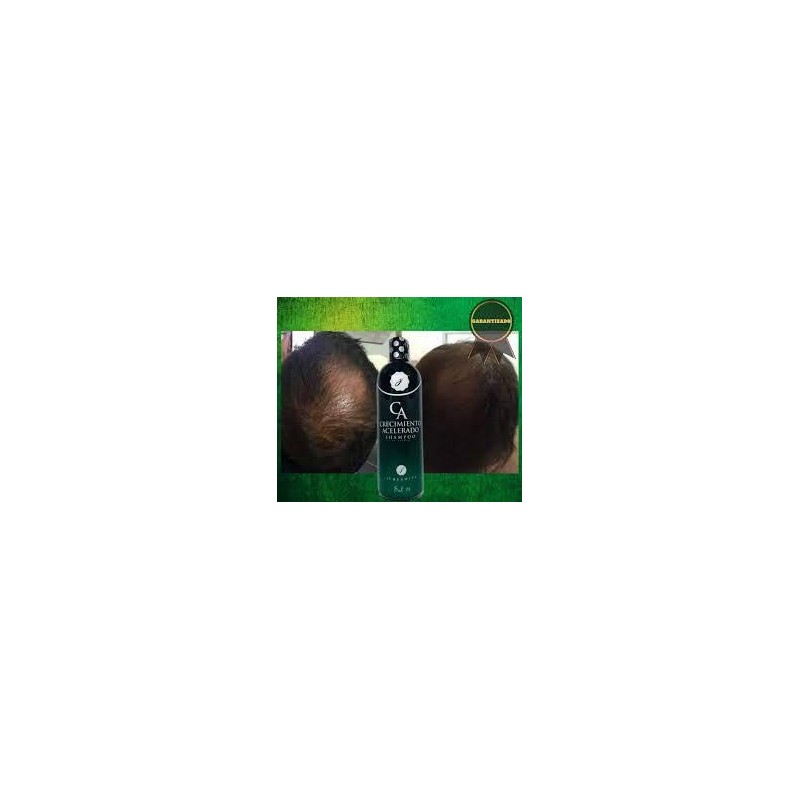 shampoo crecimiento acelerado jehesmipa detiene la caída excesiva del cabello