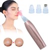 Rechargeable Electric Blackhead Removal Machine Vacuum Suction Face Pore CleanerChampagne