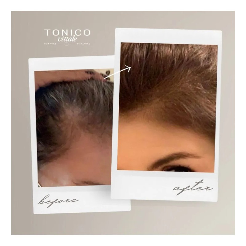 Shampoo Tonico Vittale Cabello Efecto Lacio Repara Protege