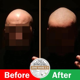 Zero Shine 2.0 | 74g | Glatzenpflege matt | Anti-Shine | Pflegende Glatzencreme | Kopfhaut Pflege mattierend | Feuchtigkeitsspendend | Ideal bei Haarpigmentierung (SMP)