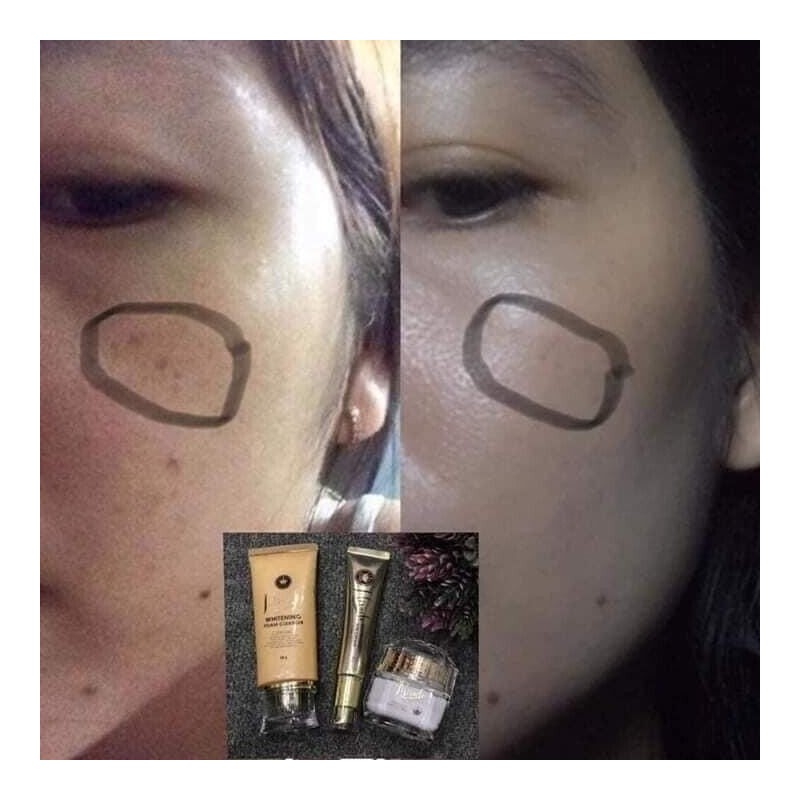 Miracle Dr. Tiara 3pc