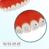 10 Paquetes de Soportes Dentales Cerámicos para Brackets Ortodónticos de