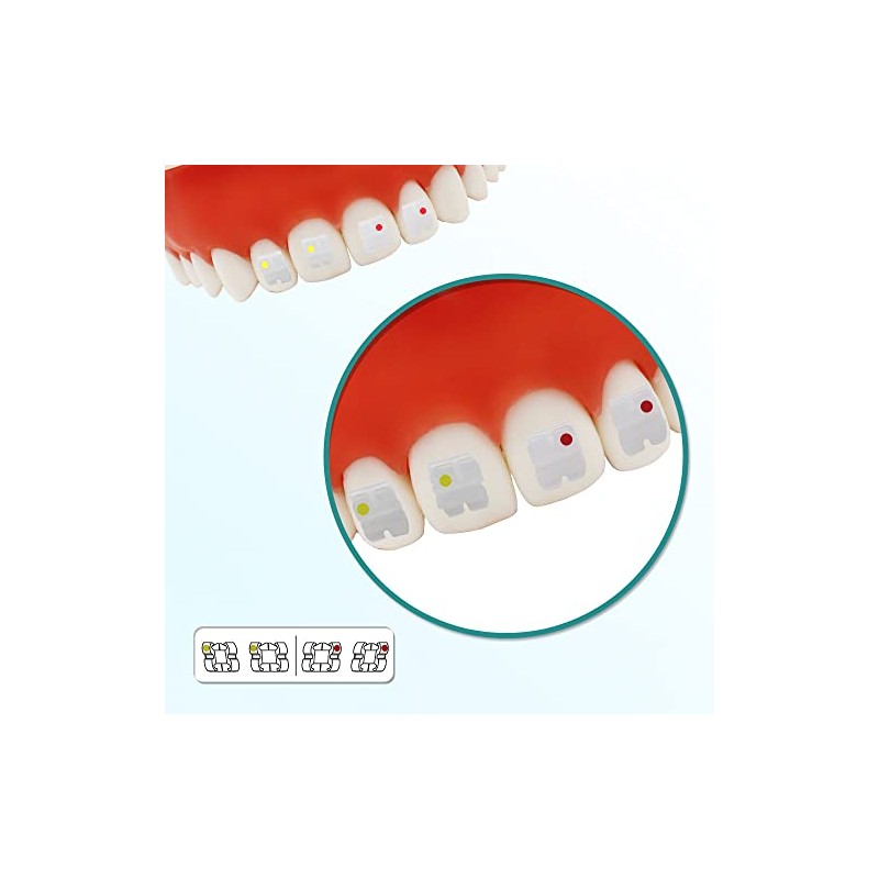 10 Paquetes de Soportes Dentales Cerámicos para Brackets Ortodónticos de