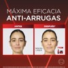 L'Oreal Paris Revitalift Laser Sérum Rostro Triple Acción Anti-Edad,Corrige Arrugas,