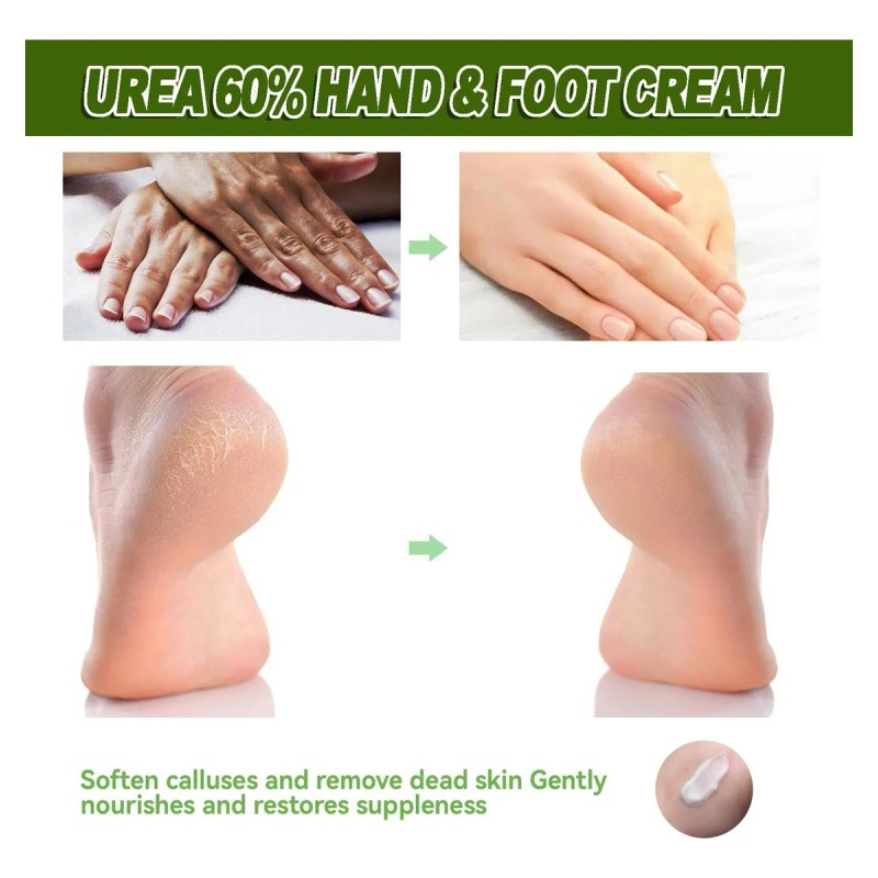 Crema Hidratante Para Pies Resecos Y Agrietados Moisturizing