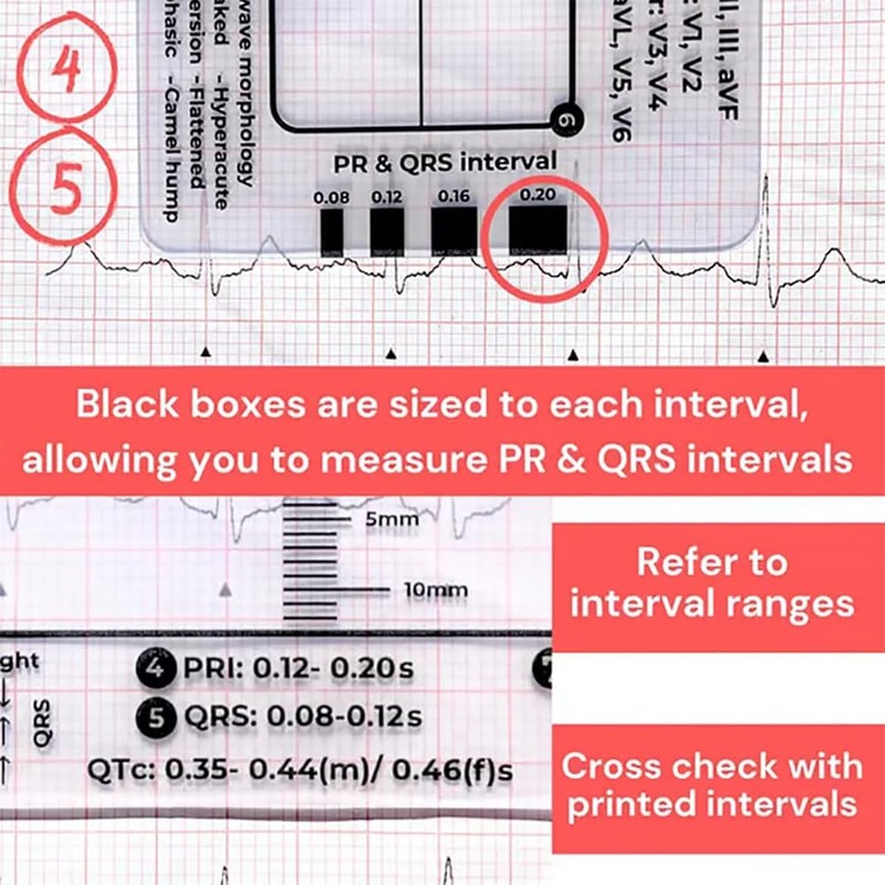 1Pc ECG 7 Step Ruler, ECG 7 Step Ruler for