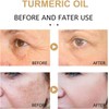 Turmeric Serum, Dark Spot Correcting Serum, Hyperpigmentation Treatment, Dark Spot
