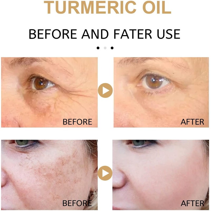 Turmeric Serum, Dark Spot Correcting Serum, Hyperpigmentation Treatment, Dark Spot