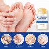 60% Urea Hydrating and Anti-Cracking Foot Cream, 2026 Upgraded Moisturising