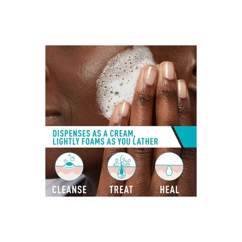 Cerave Acné Tratamiento Limpiador Facial En Espuma 150ml.