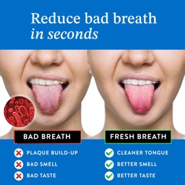 Mouthology Mouthology Tongue Scraper For Adults (2 Pack), Reduce Bad Breath, Metal Tongue Scraper, Tongue Cleaner, Tongue Scraper, Stainless Steel Tongue Scraper, Tongue Cleaner for Adults, Tongue Scrubber