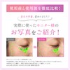 Anymor（エニモ）スキンリペアエッセンス 30ml 医薬部外品 美容液 薬用【もう迷わない！これ一本でまるっと全方位ケア】ナイアシンアミド トラネキサム酸 パンテノール サリチル酸 ニキビ 毛穴