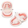 Dental Disease Caries Teeth Model Resin Simulation Teaching Prop Dental