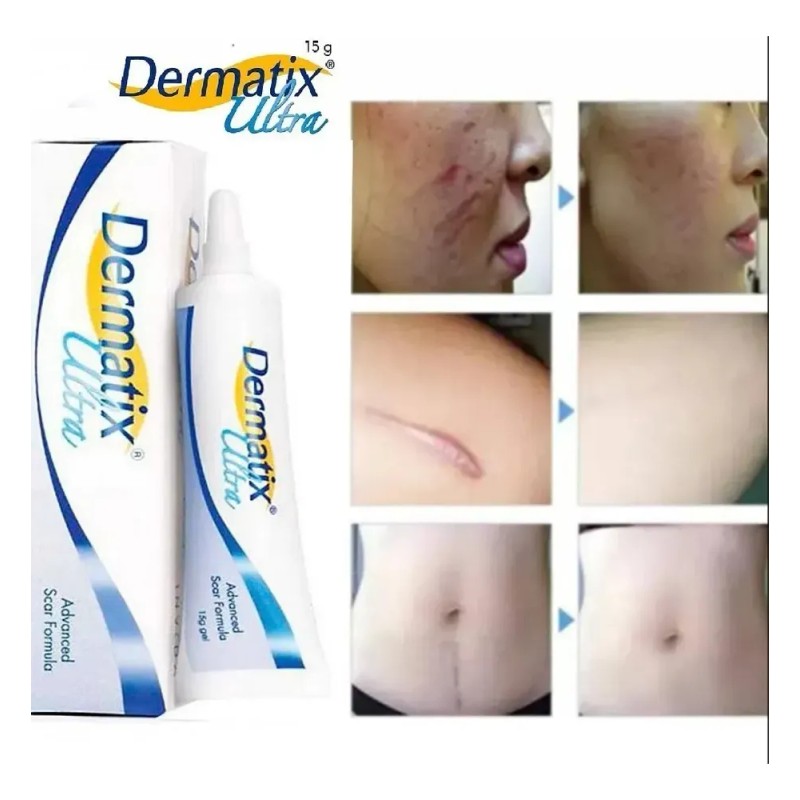 Adermatix Ultra Cream 15 G × 2 Para Todo Tipo