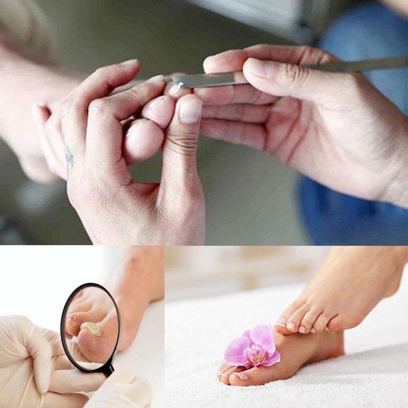 Exfoliating Ingrown Toenail Removal Pedicure Knife,Decorative Foot Knives for Ingrown