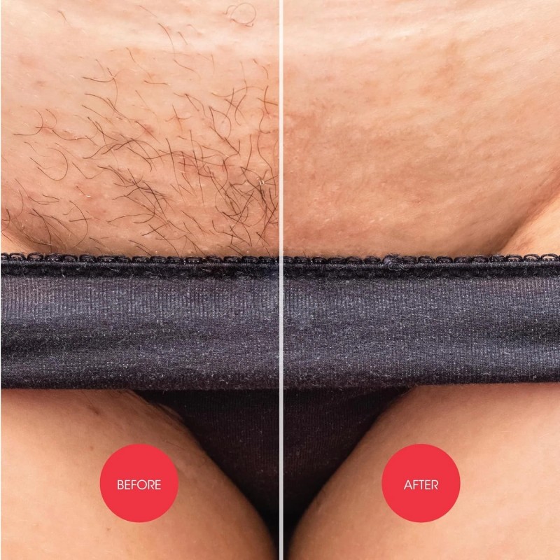 Nad's Down Under Cream for Women, Intimate Hair Removal Cream