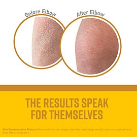 O 'Keeffe k0120030 Piel Reparación Bomba Botella