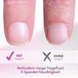 Nail Oil for Cuticle & Nail Care, Cuticle Oil for Rich Deep Care, 12 ml Cuticle Oil, Nail Care Oil - Nail Oil Pen, Nail Cream and Nail Butter Alternative, Pics Nails