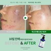 Mad Skin Care Rescue Serum 1. Rescue Serum 120mlx1 /