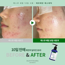 Mad Skin Care Rescue Serum 1. Rescue Serum 120mlx1 / 매드스킨케어 레스큐 세럼 1.레스큐 세럼 120mlx1개