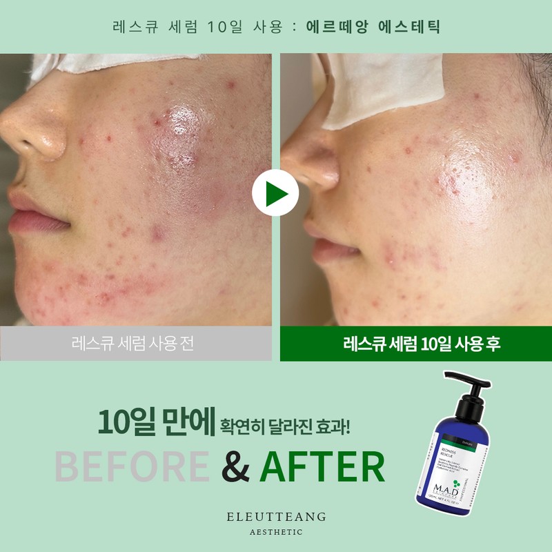 Mad Skin Care Rescue Serum 1. Rescue Serum 120mlx1 /