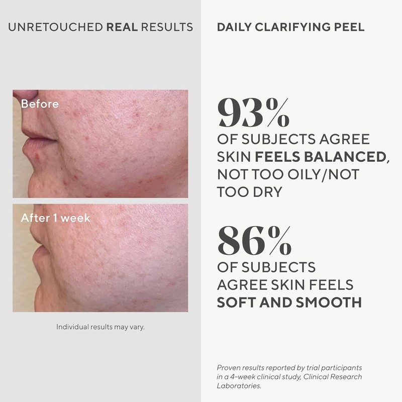 Murad Daily Clarifying Peel – Exfoliating Peel Solution – Resurfacing