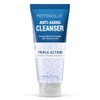 Anti-Aging Gel Cleanser, 5 Ounce