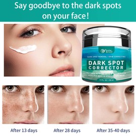 Paradise Emerald Dark Spot Remover for Face, Hyperpigmentation Treatment, Melasma, Freckle, Sun Spots Removal for All Skin Types Dark Spot Corrector for Men and Women