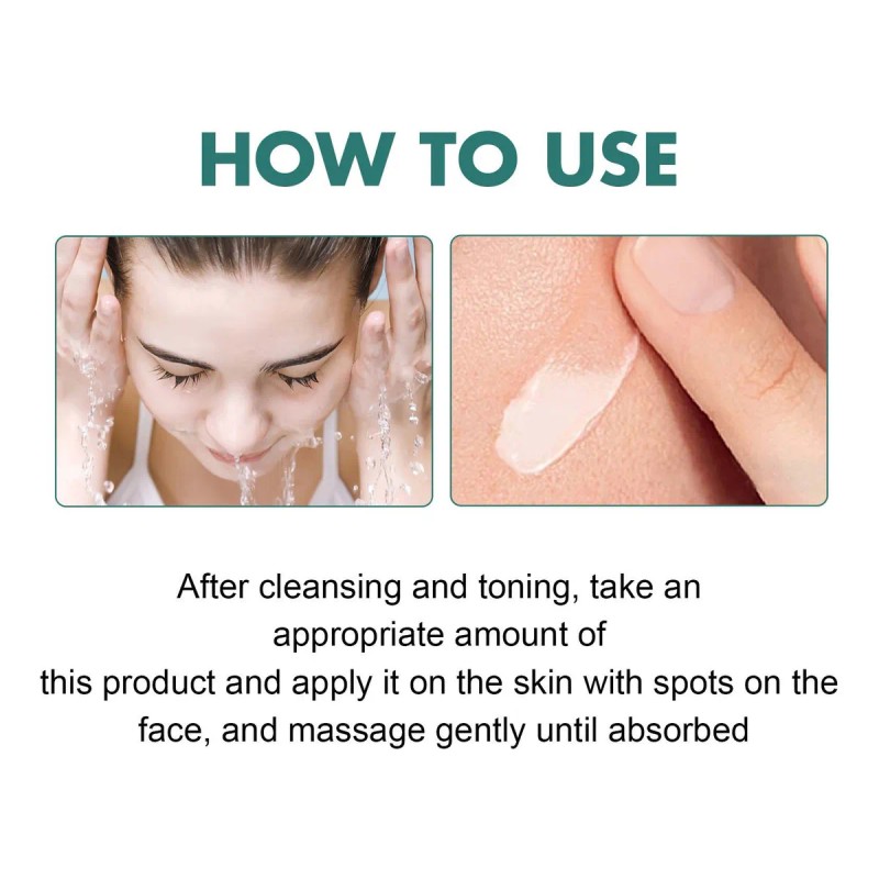 Crema Eliminadora De Pecas Y Blanqueamiento Hd Xifei