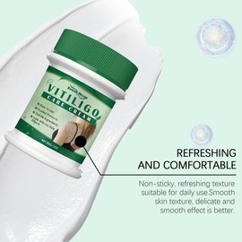 Vitiligo Cream, Natural Effective Vitiligo Treatment for Reduce White Spots and Improve Skin Pigmentation - Volume: 60g