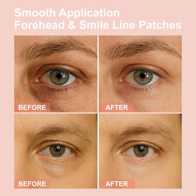 Micro Eye Patches, Deeply Hydrating Anti-Wrinkle Patches, Contains Hyaluronic Acid