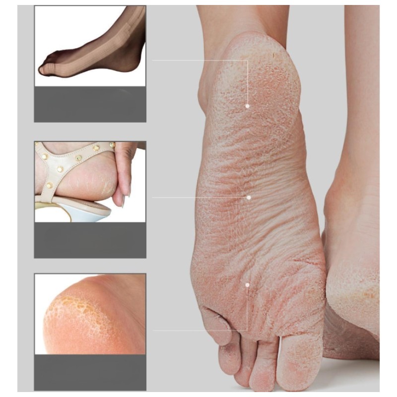 ARIUL Smooth & Pure Foot Peeling Mask 34g*2ea, Type:Rice Nourishing