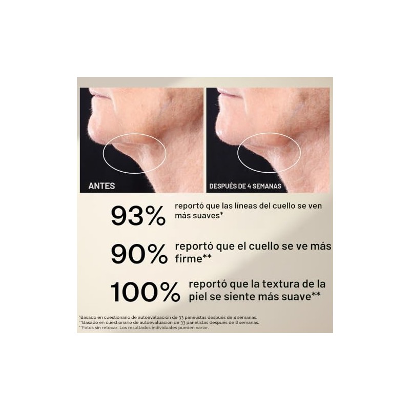 StriVectin Peptight Tightening Neck Suero tensor para el cuello alisa