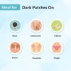 Only Kosher Candy Kosher Nigrifix Cream For Acanthosis Nigricans |
