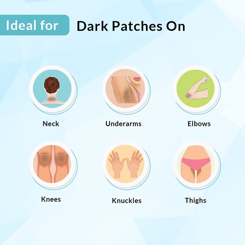 Only Kosher Candy Kosher Nigrifix Cream For Acanthosis Nigricans |
