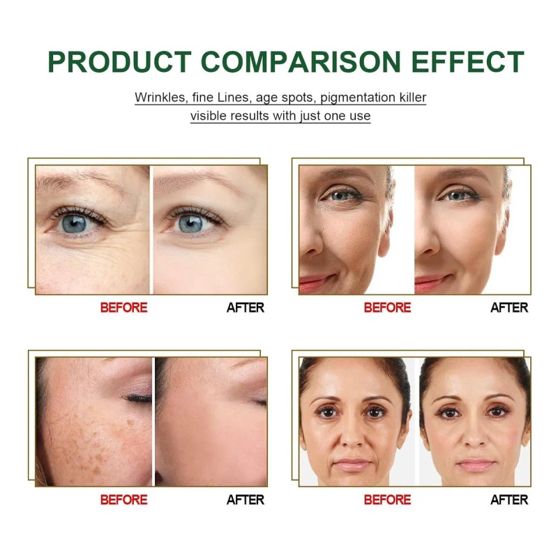 Suero Facial · Péptidos 10% · Anti-edad Y Arrugas 2pc